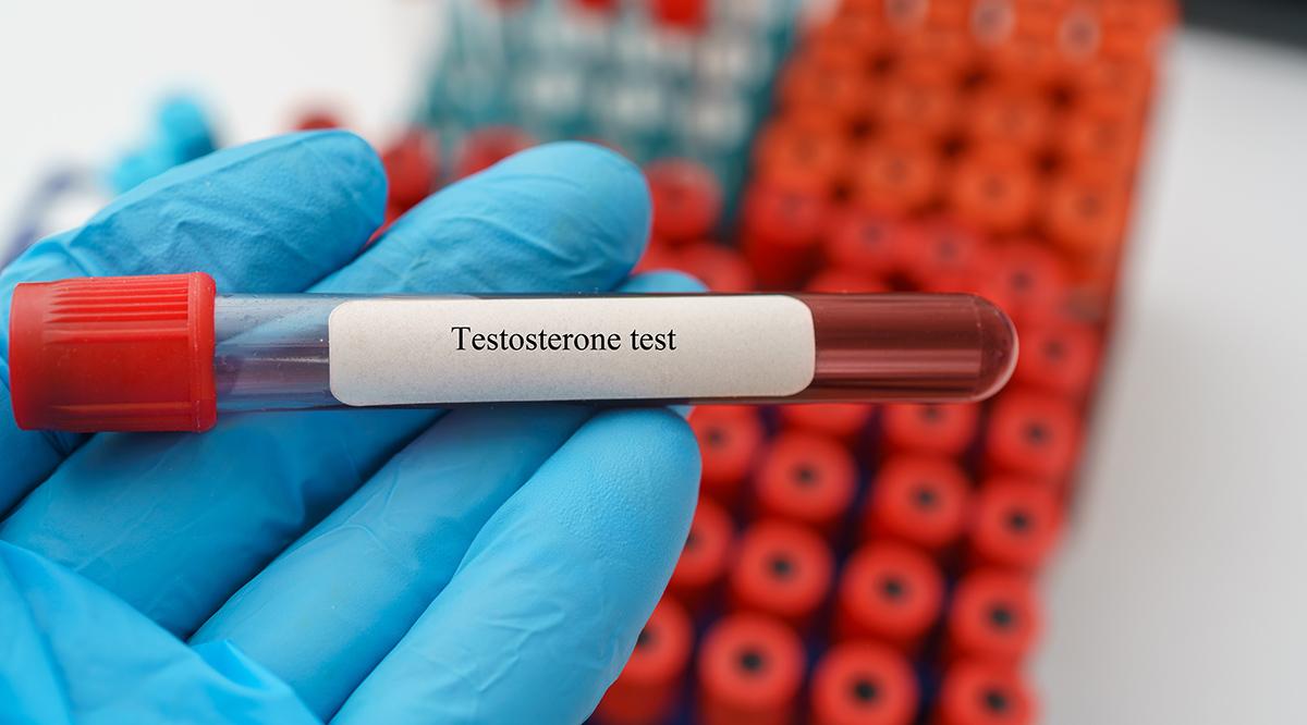 Testosterone blood test